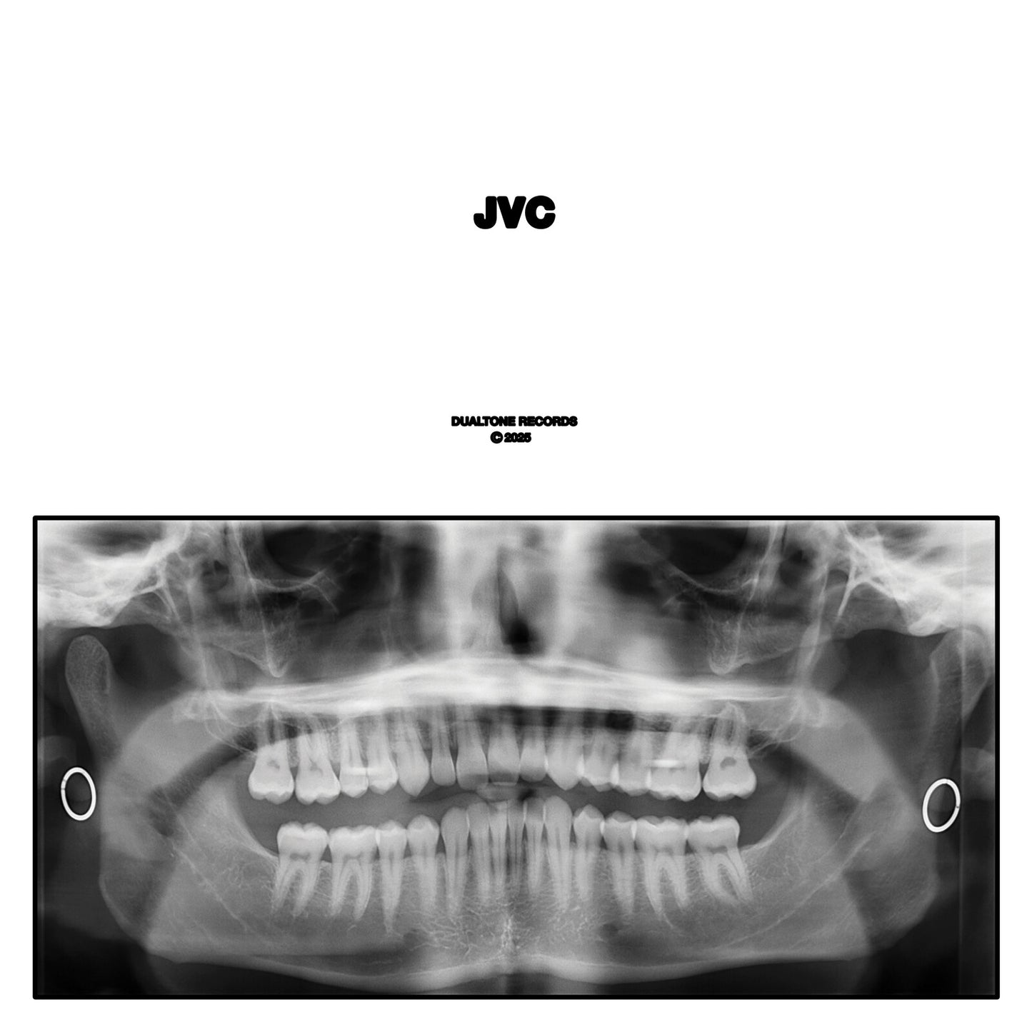 CD cover featuring a black and white dental X-ray image.