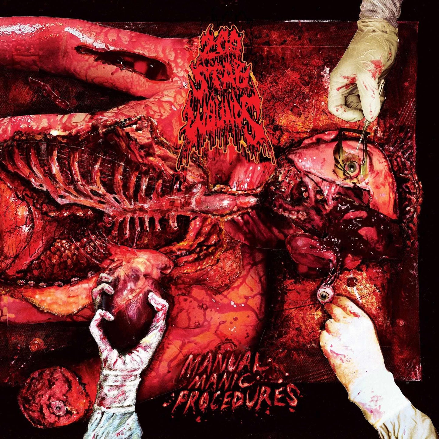 CD cover depicting graphic surgical imagery with blood and anatomical detail.