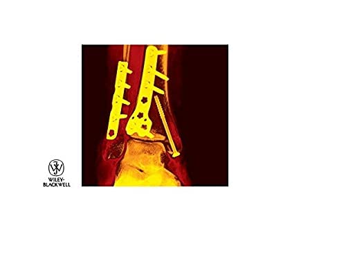 Orthopaedics and Fractures (4th Revised edition)