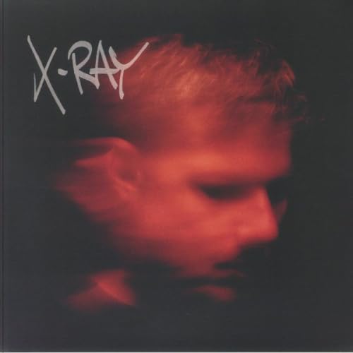 Red-toned portrait of a person’s face with “X-RAY” text above.