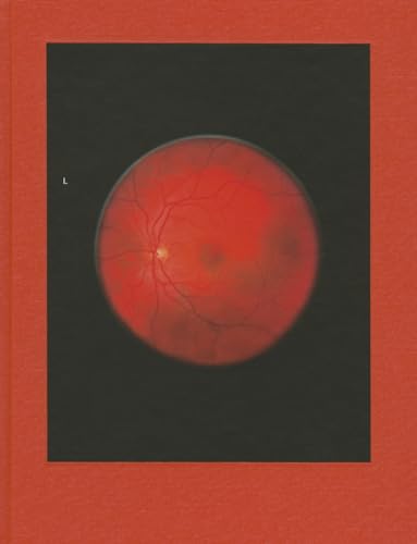 Mikhael Subotzky: Retinal Shift