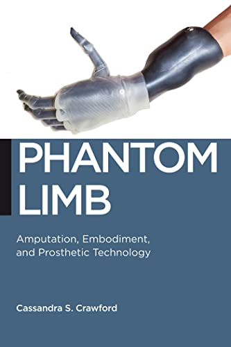 Phantom Limb: Amputation