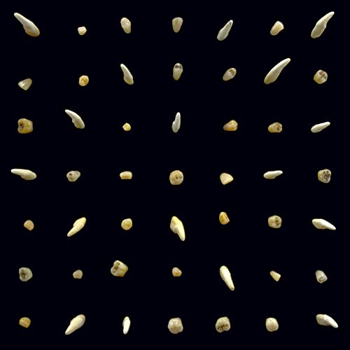 Black background covered in a grid of small, scattered teeth.