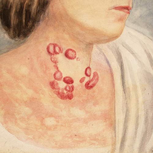 CD cover depicting a painted portrait with red marks on skin.