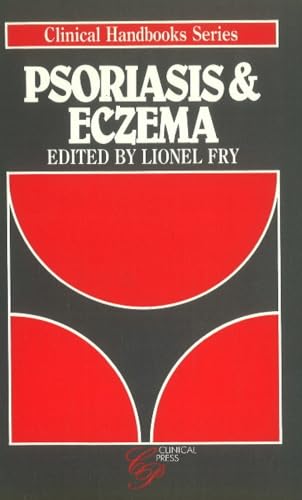 Psoriasis and Eczema