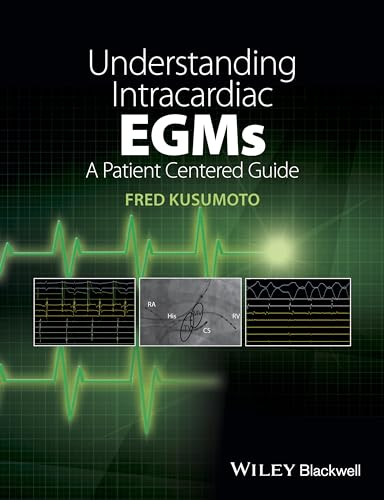 Understanding Intracardiac EGMs: A Patient Centered Guide