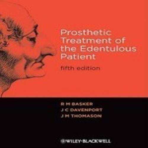 Prosthetic Treatment of the Edentulous Patient