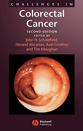 Challenges in Colorectal Cancer