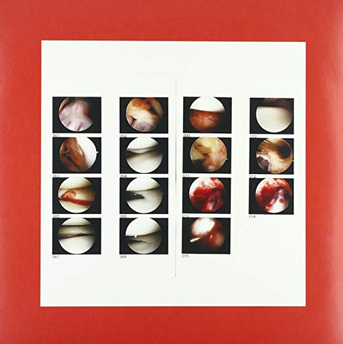 Album cover with a grid of circular, colorful, abstract images.