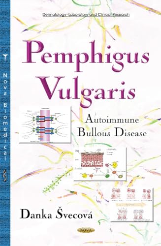 Pemphigus Vulgaris