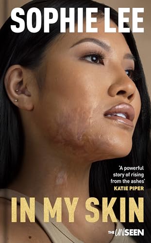In My Skin : Learning to love your perfectly imperfect life