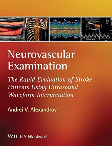 Neurovascular Ultrasound Examination and Waveform Interpretation