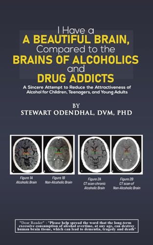 I Have a Beautiful Brain, Compared to the Brains of Alcoholics and Drug Addicts : A Sincere Attempt to Reduce the Attractiveness of Alcohol for Children, Teenagers, and Young Adults