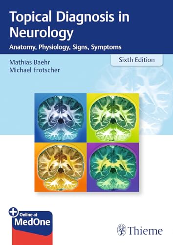 Topical Diagnosis in Neurology: Anatomy