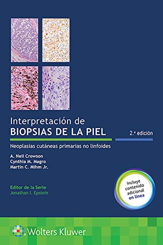 Interpretacion de biopsias de la piel: Neoplasias cutaneas primarias no linfoides