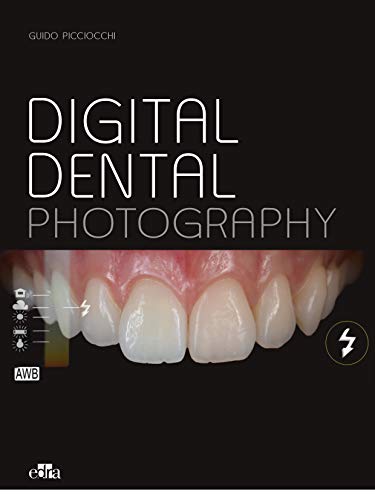 Esthetic Implants - 2 books