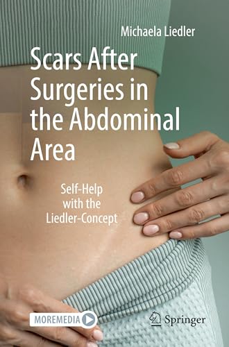 Scars After Surgeries in the Abdominal Area : Self-Help with the Liedler-Concept