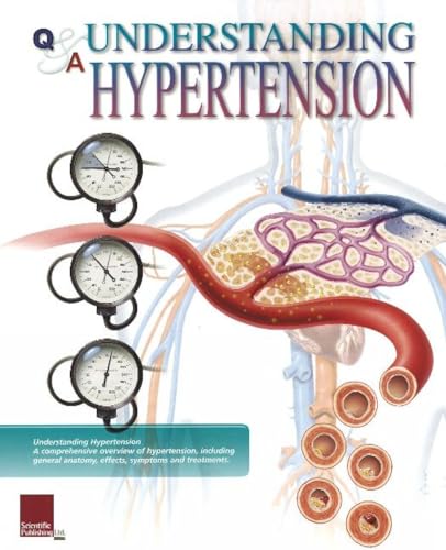 Understanding Hypertension Flip Chart