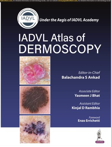 Book cover: "IADVL Atlas of Dermoscopy" with skin lesion images.