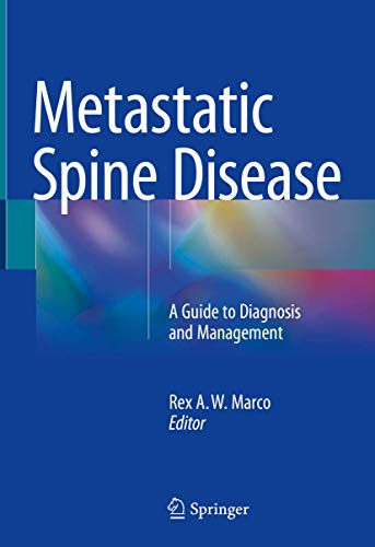 Metastatic Spine Disease: A Guide to Diagnosis and Management
