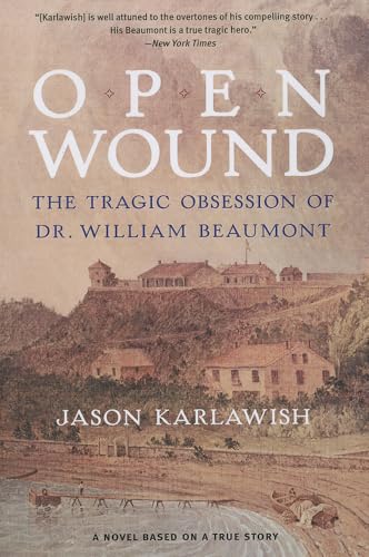 Open Wound : The Tragic Obsession of Dr. William Beaumont