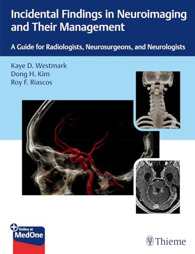 Incidental Findings in Neuroimaging and Their Management : A Guide for Radiologists, Neurosurgeons, and Neurologists
