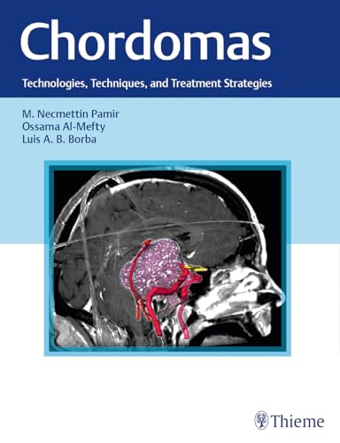 Chordomas: Technologies