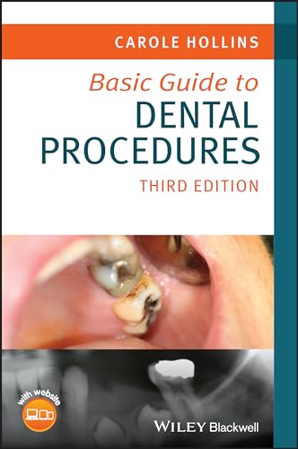 Basic Guide to Dental Procedures