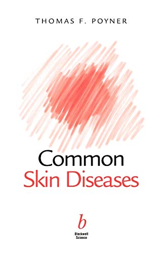 Common Skin Diseases