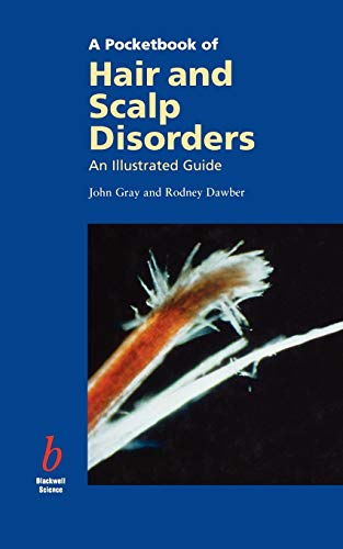 Pocketbook of Hair and Scalp Diseases: An Illustrated Guide
