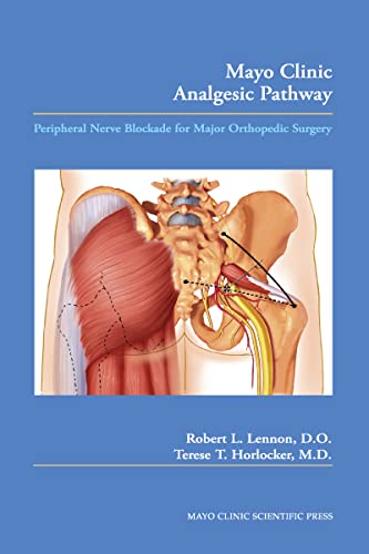 Mayo Clinic Analgesic Pathway Perip