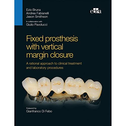 Fixed prosthesis with vertical margin closure