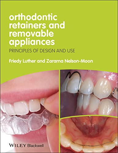 Removable Orthodontic Appliances and Retainers: Principles of Design and Use