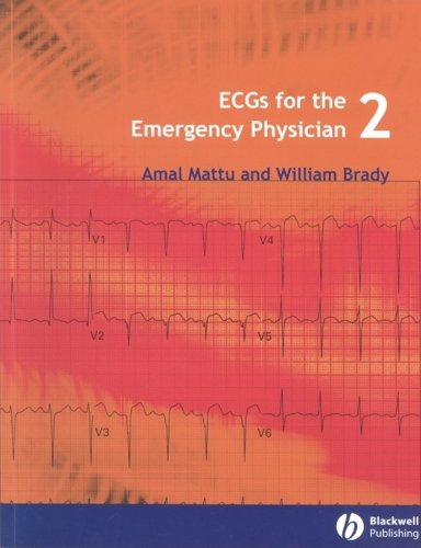 ECGs for the Emergency Physician 2: Level 2