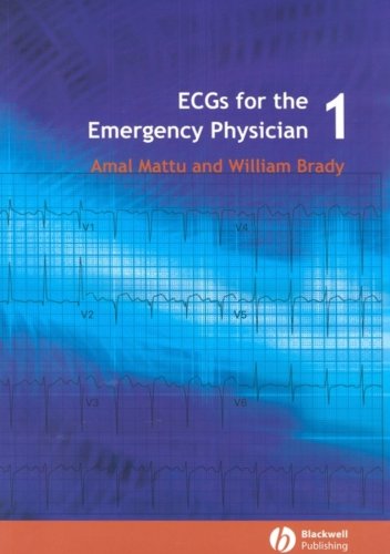 ECGs for the Emergency Physician 1: Level 1