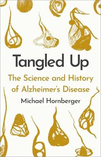 Tangled Up : The History and Science of Alzheimer's Disease