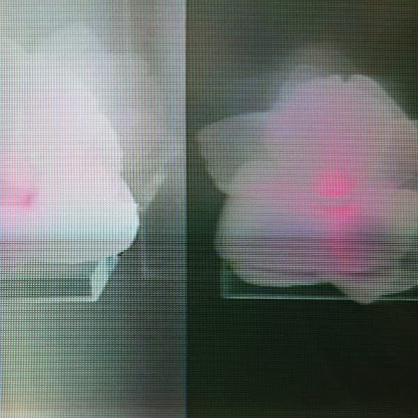 Blurred X-ray image showing a human skull and jawline.