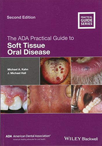 The ADA Practical Guide to Soft Tissue Oral Disease