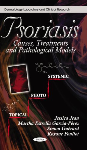 Psoriasis