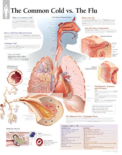 Common Cold vs the Flu Laminated Poster
