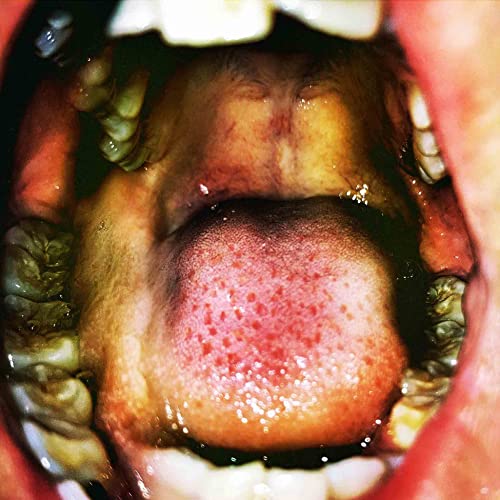 Close-up of an open mouth with tongue and teeth visible.