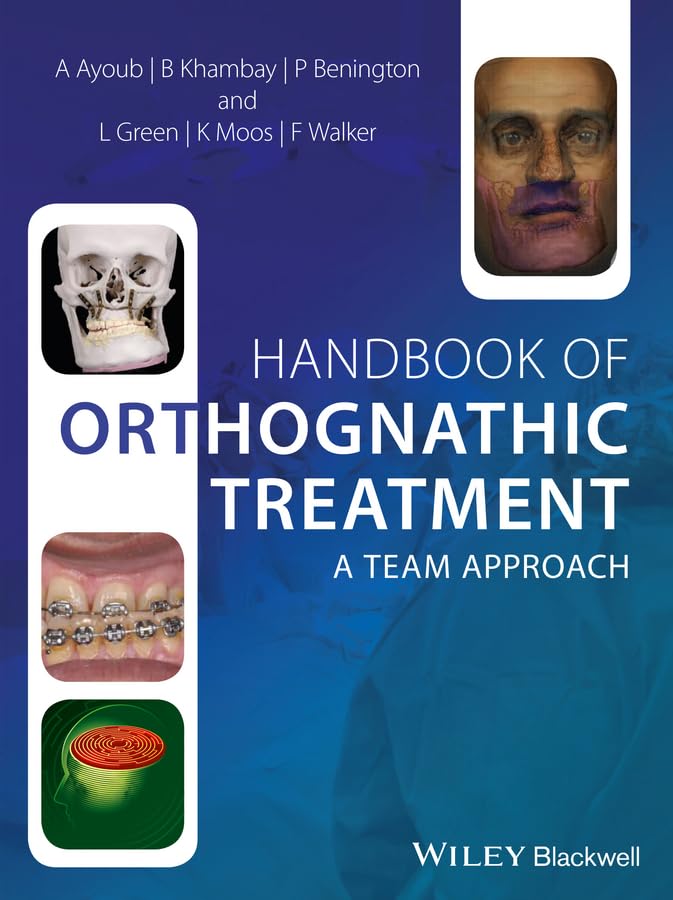 Handbook Of Orthognathic Treatment