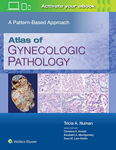 Atlas of Gynecologic Pathology : A Pattern-Based Approach: Print + eBook with Multimedia