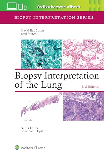 Biopsy Interpretation of the Lung : Print + ebook with Multimedia