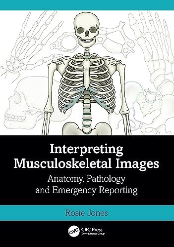 Interpreting Musculoskeletal Images : Anatomy, Pathology and Emergency Reporting