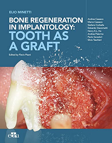 Bone regeneration in implantology: tooth as a graft