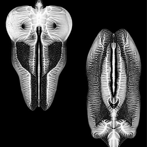 Black and white abstract image of two symmetrical, organic shapes.