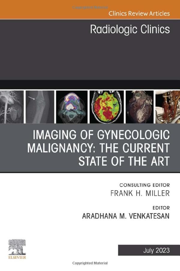 Imaging of Gynecologic Malignancy: The Current State of the Art, An Issue of Radiologic Clinics of North America (Volume 61-4) (The Clinics: Radiology, Volume 61-4)