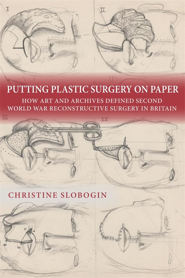 Putting Plastic Surgery on Paper : How Art and Archives Defined Second World War Reconstructive Surgery in Britain