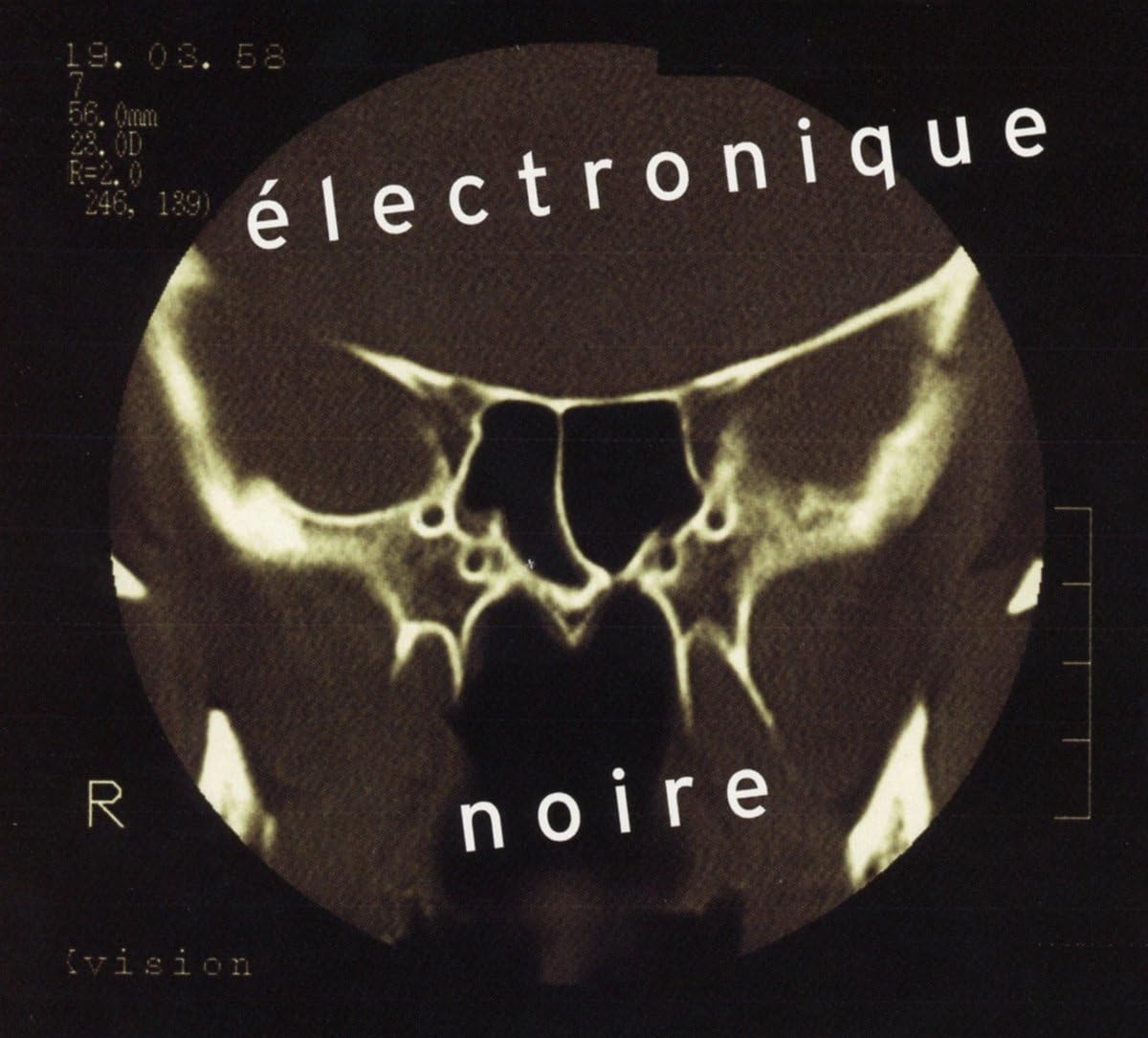 CD cover with a black and white medical scan image and text.
